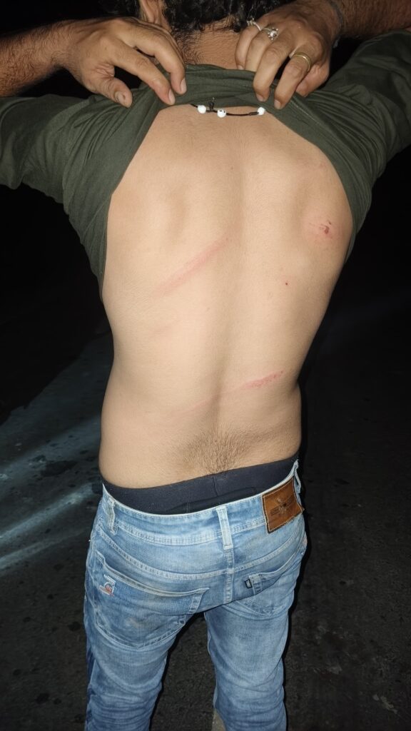 Barabanki News: बाइक सवार बेख़ौफ़ बदमाशों ने सर्राफा व्यवसायी के भाई को बनाया निशाना, मारपीट कर लाखों का सोना-चांदी लूटकर हुए फरार