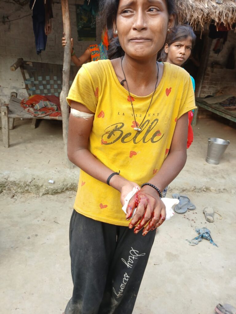 Barabanki: पुरानी रंजिश में दबंगों ने घर में घुसकर धारदार हथियारों से किया हमला, माता-पिता सहित आधा दर्जन लोग घायल