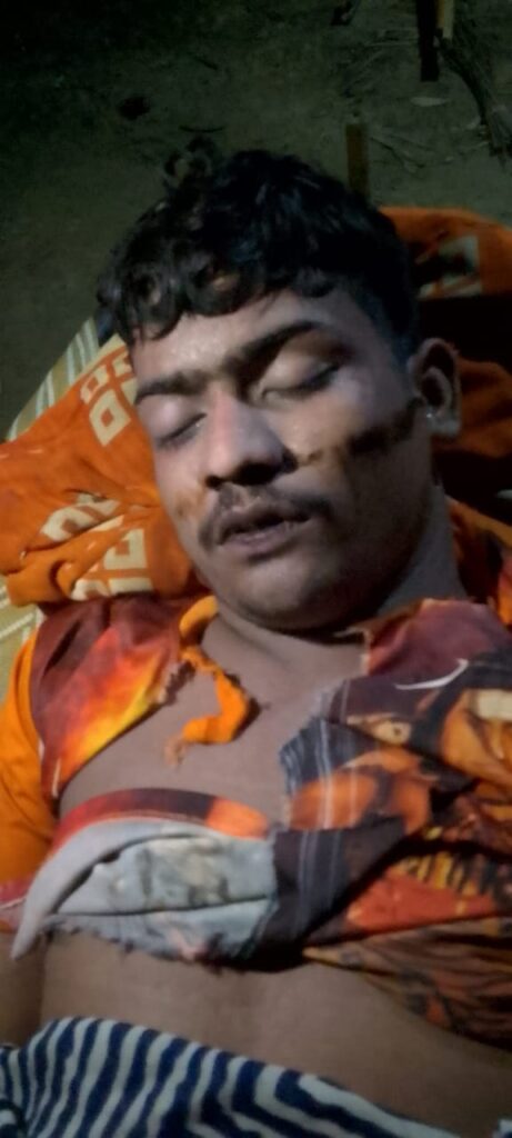 Barabanki के कमोली गांव का युवक मजदूरी के लिए गुजरात गया था, लेकिन संदिग्ध परिस्थितियों में मौत हो गई। शव पर चोटों के निशान देखकर परिजनों ने ठेकेदार पर हत्या का आरोप लगाया। पुलिस की लापरवाही से भड़के ग्रामीणों ने शव चौराहे पर रखकर प्रदर्शन किया।