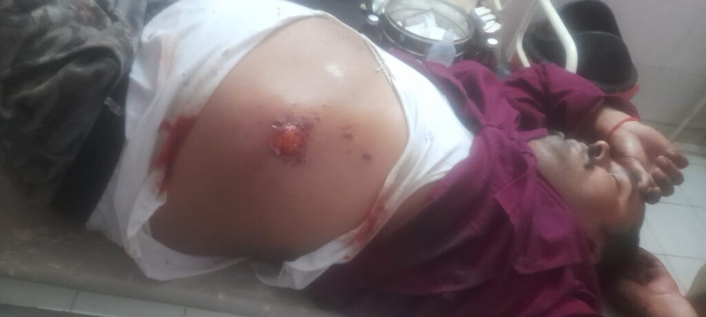 बाराबंकी में ई-रिक्शा चार्ज करने को लेकर बवाल: पेट्रोल पंप पर मारपीट और फायरिंग, गोली लगने से युवक गंभीर रूप से घायल