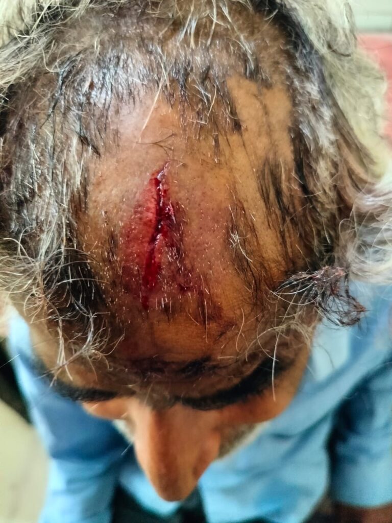 Barabanki: राजनीतिक संरक्षण के चलते जानलेवा हमले और डकैती के आरोपियों को गिरफ्तार नहीं कर रही पुलिस — दहशत में पीड़ित परिवार, कोर्ट के आदेश पर दर्ज हुई थी FIR