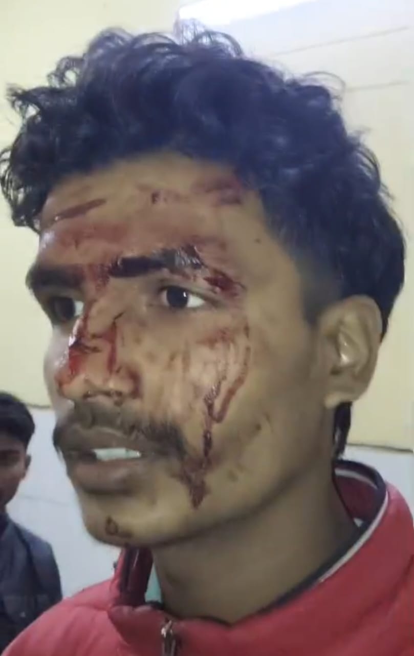 Barabanki: लखनऊ-अयोध्या हाईवे पर भीषण सड़क हादसा, अनियंत्रित होकर पलटी गोरखपुर से दिल्ली जा रही डबल डेकर बस, 10 यात्री घायल