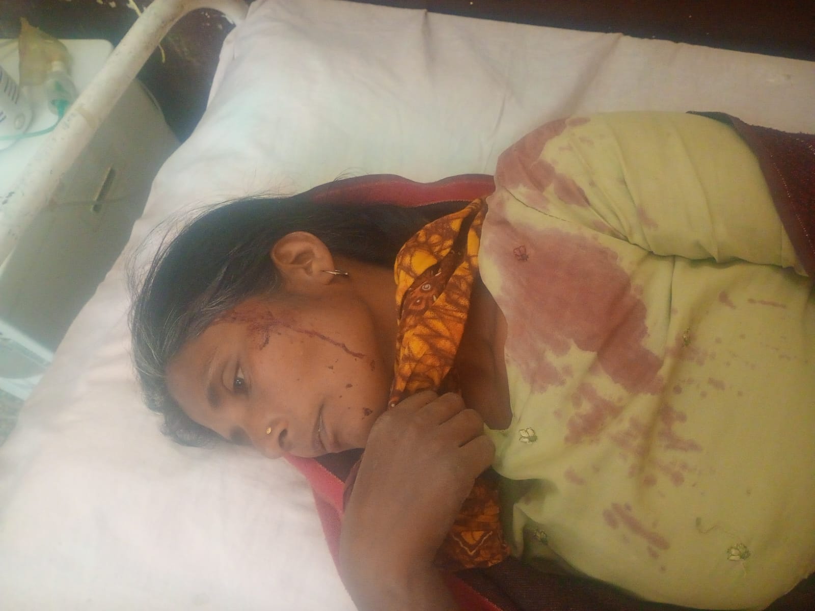 Barabanki News: महिला और उसके परिवार पर जानलेवा हमला, कार्रवाई के बदले सुलह का दबाव बनाने में जुटी पुलिस; पीड़िता ने एसपी से लगाई न्याय की गुहार