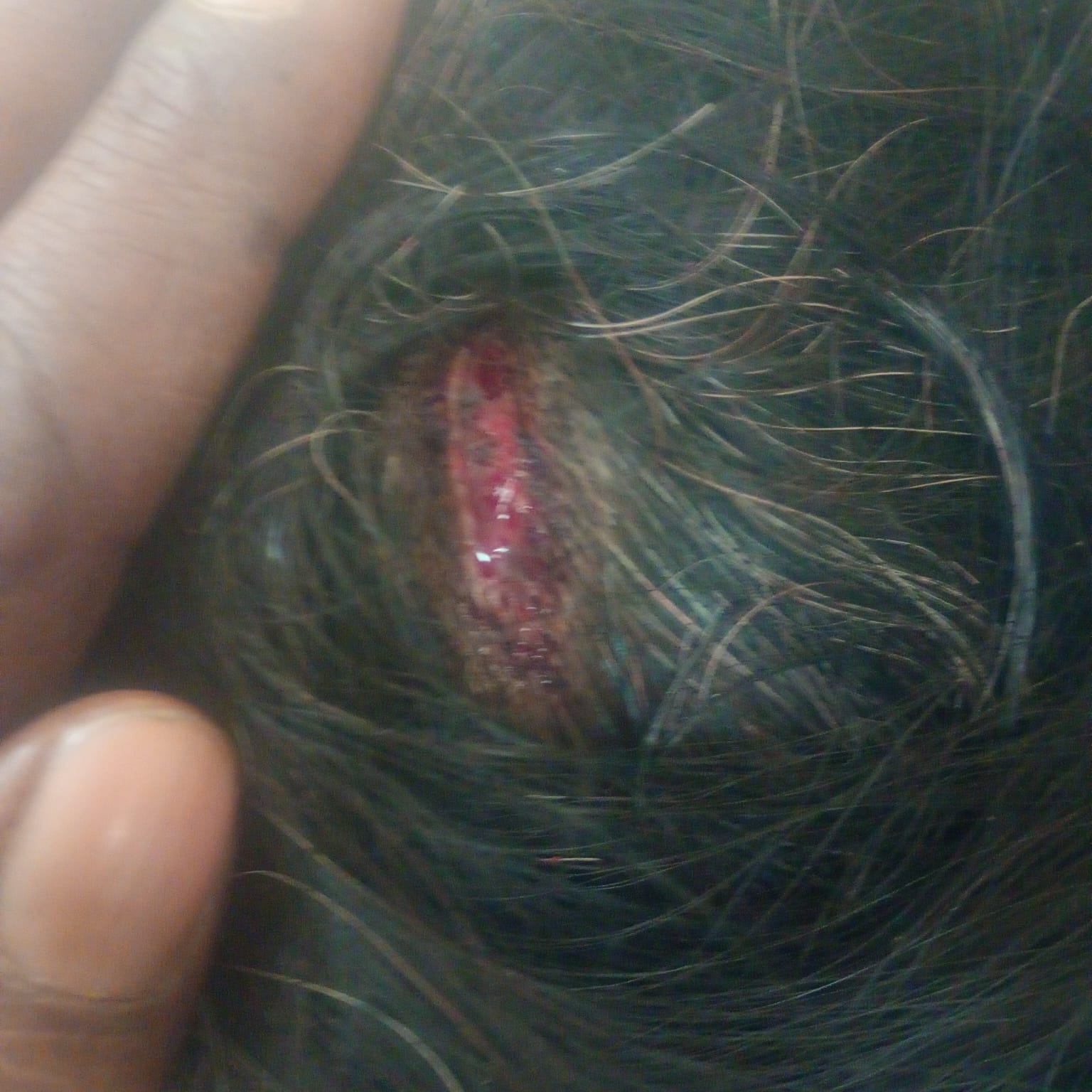 Barabanki News: महिला और उसके परिवार पर जानलेवा हमला, कार्रवाई के बदले सुलह का दबाव बनाने में जुटी पुलिस; पीड़िता ने एसपी से लगाई न्याय की गुहार