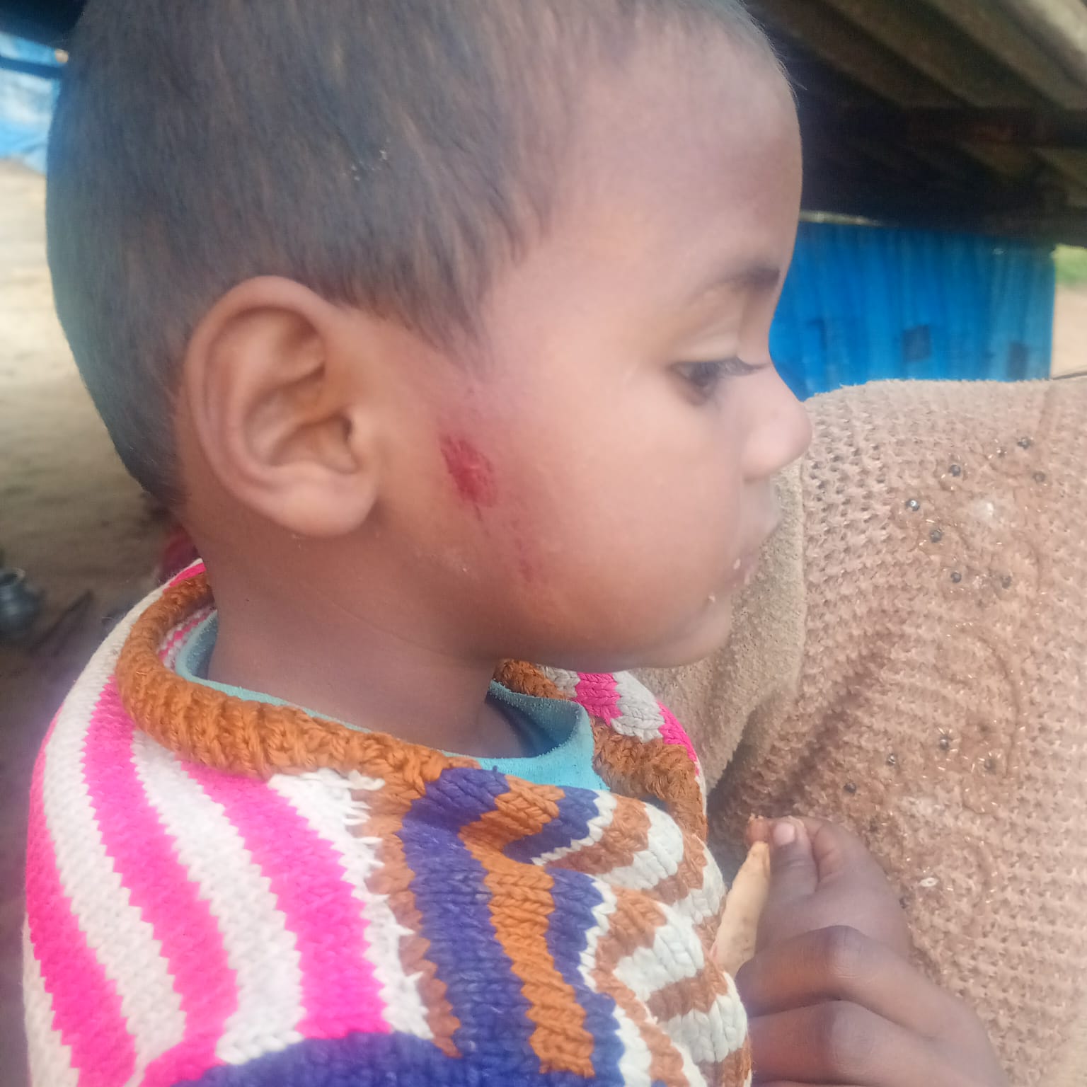 Barabanki News: महिला और उसके परिवार पर जानलेवा हमला, कार्रवाई के बदले सुलह का दबाव बनाने में जुटी पुलिस; पीड़िता ने एसपी से लगाई न्याय की गुहार