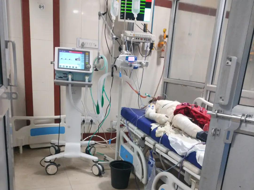 Barabanki News: मायके में रह रही पत्नी को विदा कराने पहुंचे युवक की जलकर मौत, साले पर हत्या का आरोप