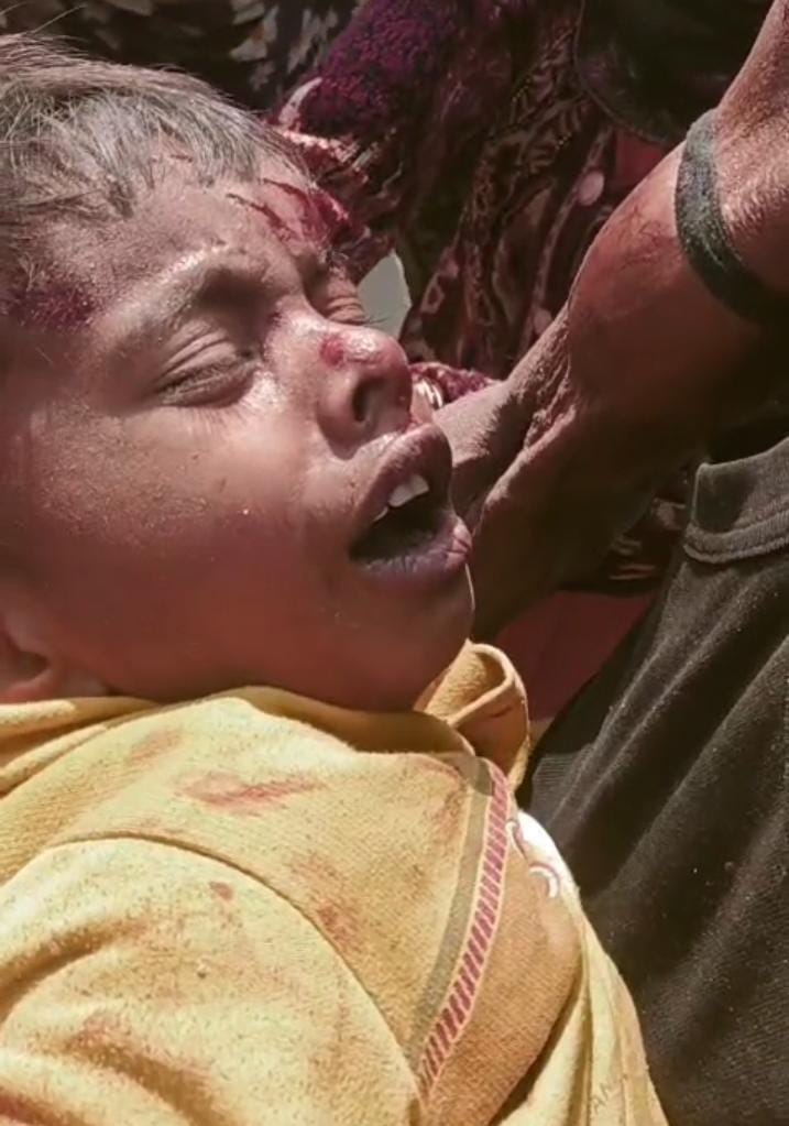 Barabanki News: तेज़ रफ़्तार बाइक चालक ने घर के बाहर खेल रहे 4 वर्षीय मासूम को मारी टक्कर, हालत गंभीर