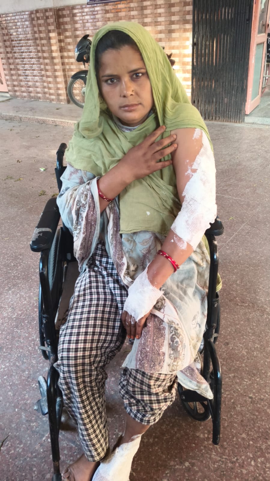 Barabanki: चूल्हे की चिंगारी से छप्परनुमा मकान में लगी भीषण आग, गंभीर रूप से झुलसी महिला, लखनऊ रेफर