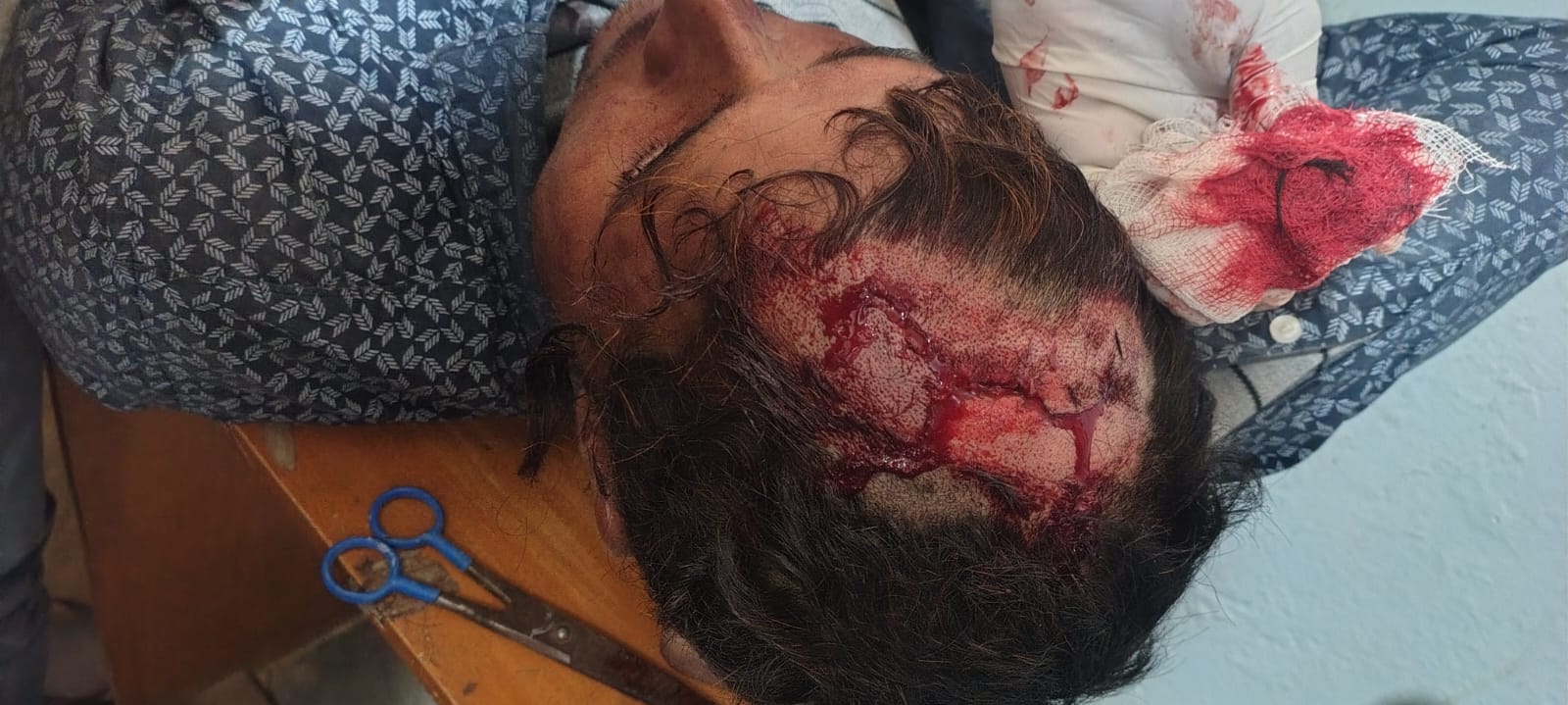 Barabanki: बोजा गांव में जातिसूचक टिप्पणी पर बवाल - मारपीट में कई घायल, पुलिस पर एकतरफा कार्रवाई का आरोप; एसपी से न्याय की गुहार 