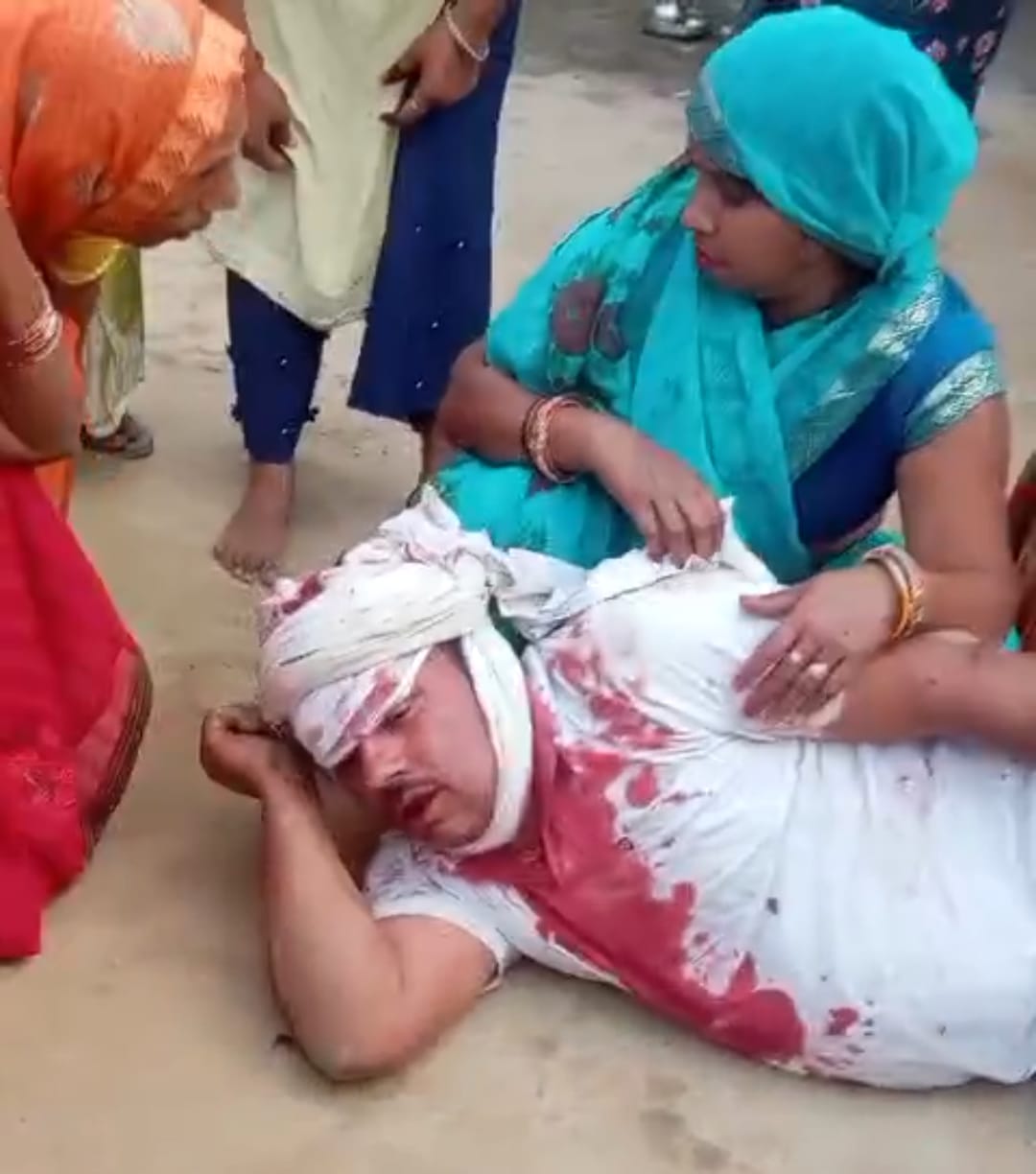 Barabanki: पुरानी रंजिश में दो पक्षों के बीच ख़ूनी संघर्ष, जमकर चले लाठी-डंडे और धारदार हथियार; आधा दर्जन गंभीर घायल
