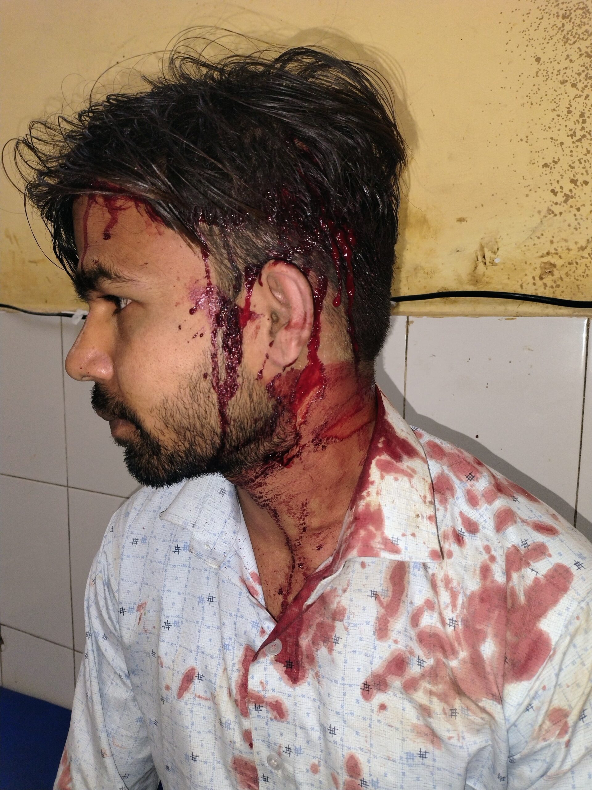 Barabanki: भीम आर्मी के झंडे का अपमान, विरोध करने पर युवक की बेरहमी से पिटाई; हंगामे के बाद दर्ज हुई FIR