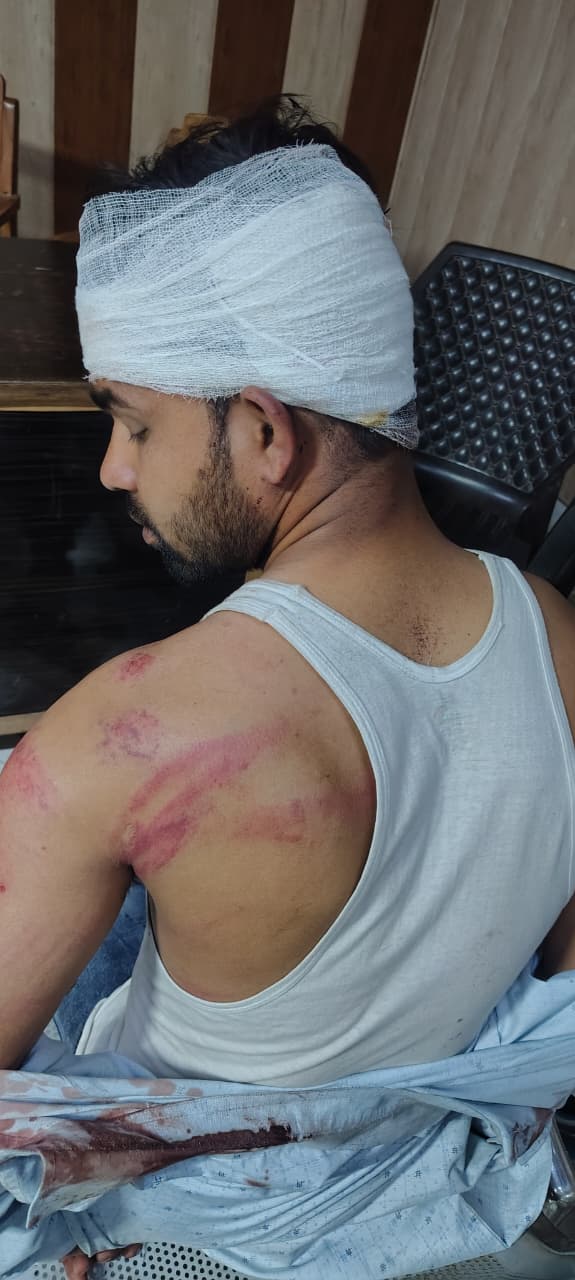 Barabanki: भीम आर्मी के झंडे का अपमान, विरोध करने पर युवक की बेरहमी से पिटाई; हंगामे के बाद दर्ज हुई FIR