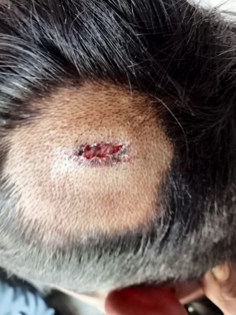 Barabanki: मोटरसाइकिल गिरने पर नाबालिग की बेरहमी से पिटाई, गंभीर हालत में अस्पताल में भर्ती; कार्रवाई न होने का आरोप